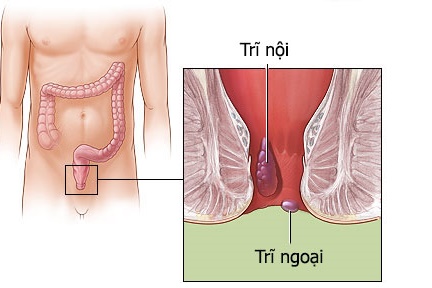 Jual Obat Wasir Ambeien De Nature Di Kupang